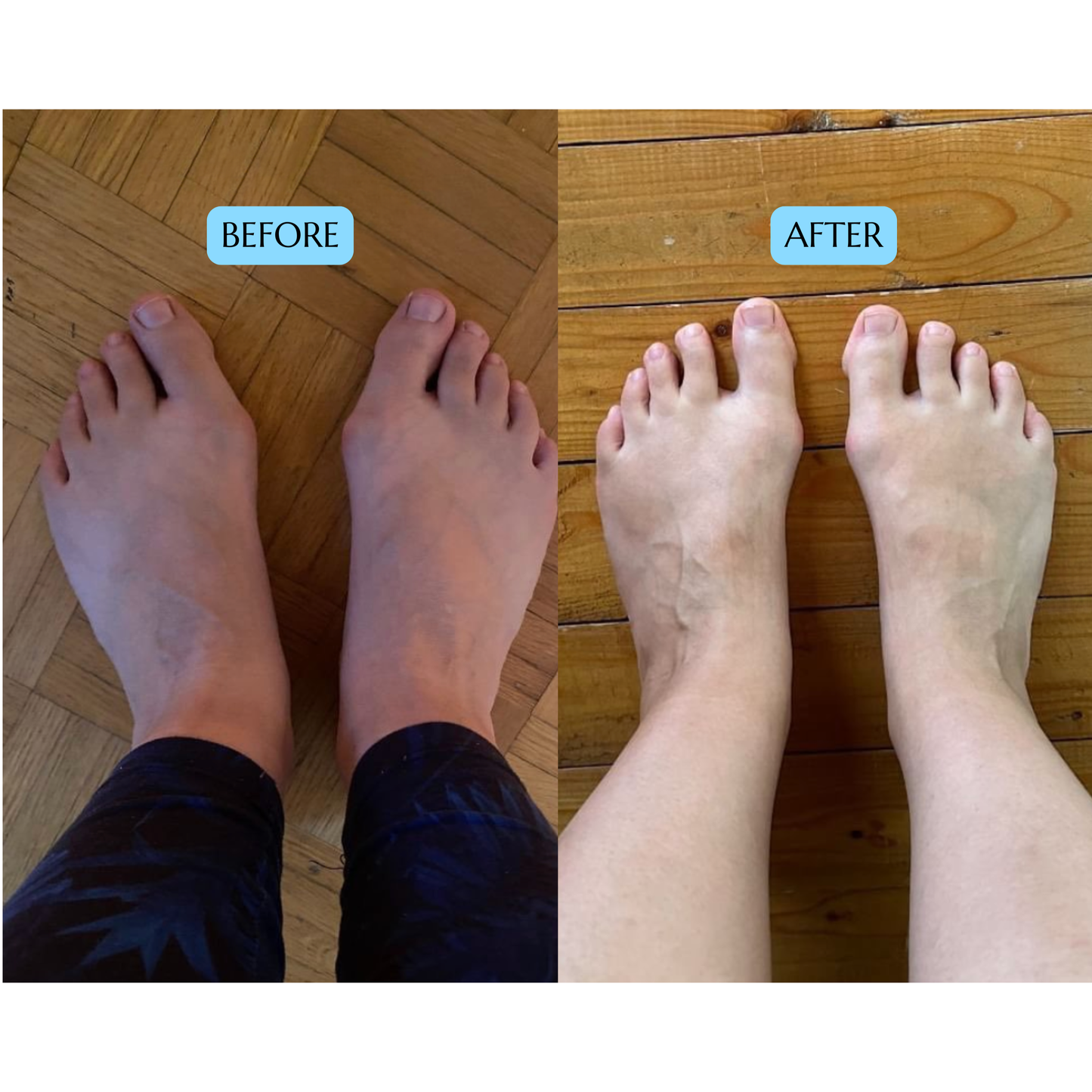 VANE - Toe Separator