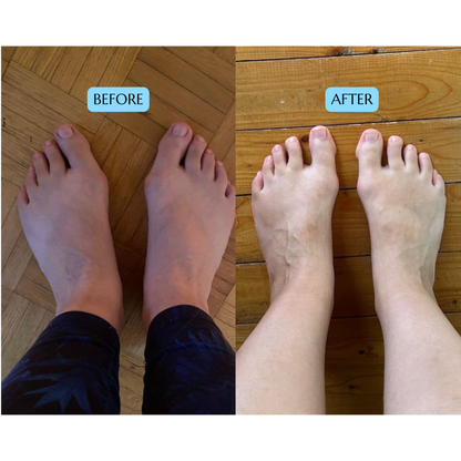VANE - Toe Separator